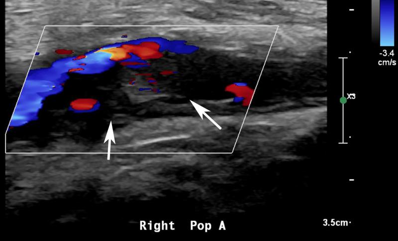 PHOTO GALLERY: How COVID-19 Appears on Medical Imaging | Imaging